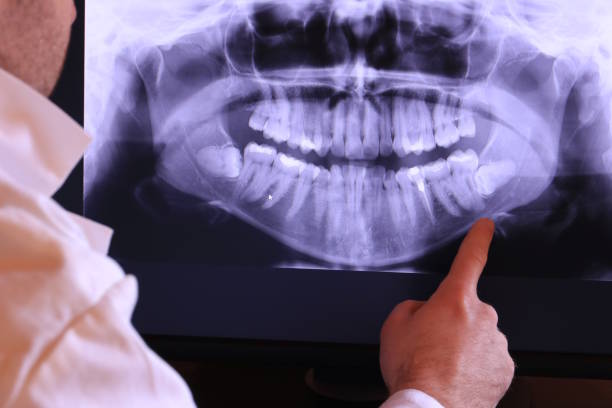 Best Emergency Treatment for Dental Infections or Abscesses in Richfield, OH