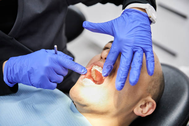 Best Emergency Treatment for Dental Infections or Abscesses in Richfield, OH